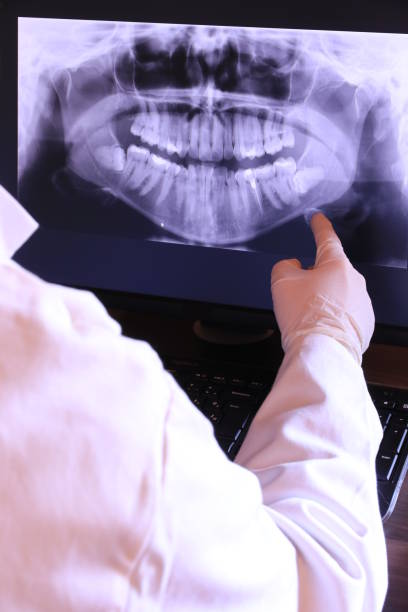Best Broken or Cracked Tooth Emergency Dentist in Nottingham, PA