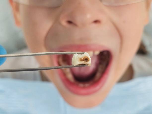 Best Orthodontic Emergency Dentist in Nottingham, PA